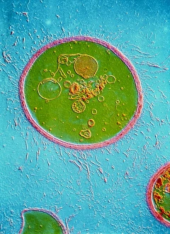 Stampe di La micrografia a colori false della Cryptococcus neoformans mostra un singolo e cerchio encapsulato lievito di levadura. La C Immagini datate 1988: Cryptococco di Cifero Neoforma