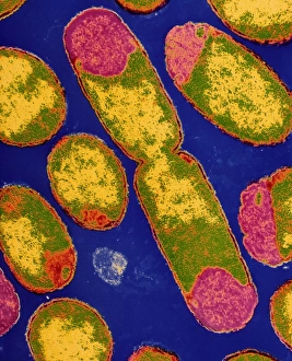 Escherichia Coli Micrograph Stampe: TEM of dividing E. coli bacterium