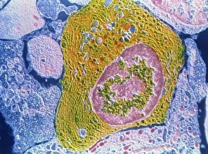 Stampe di Immagine di trasmissione elettrochimica con colore falso (TEM) di un plasmocita umana (plasma cell) Immagini datate 1989: Plasma di cellule del plasma umano TEM