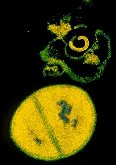 Antibiotic Resistant Bacteria Stampe: TEM Staphylococcus aureus