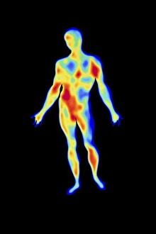 Thermography Images Stampe: Thermogram