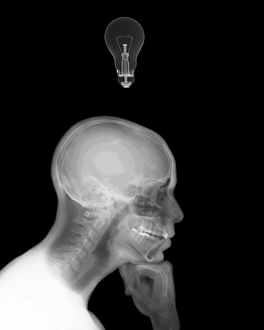 Xray Stampe: Uomo pensieroso con una lampadina