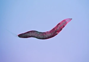 Intestinal Parasites Stampe: Threadworm, light micrograph