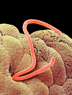 Scanning Electron Micrograph SEM Images Stampe: Threadworms in the gut, SEM