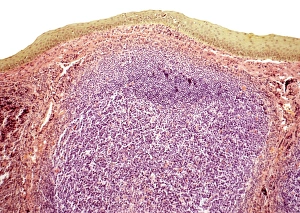 Immune System Cells Stampe: Tonsil, light micrograph