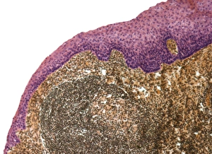 Light Microscopy Images Stampe: Tonsil, light micrograph F006 / 9818