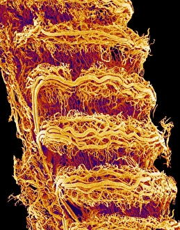 Stampe di La trachea. Microscopia elettrostatica colore della superficie esterna della trachea (trattura) collegata alla laringe (cassetta vocale) Immagini del 9 settembre 2004: Trachea