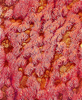 Respiratory Tract Anatomy Stampe: Trachea, SEM