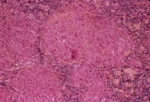 Mycobacterium Tuberculosis Bacteria Stampe: Tuberculosis, light micrograph C015 / 6400