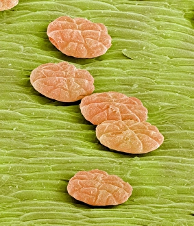 Stampe di Le ghiandole digestive del Venus flytrap sono visibili nella fotografia a raggi X colorato (SEM) di una gamba digestive della pianta di Venus flytrap (Dionaea muscipula) Immagini datate 2003 agosto: Glandi digestivi della Venus flytrap, SEM