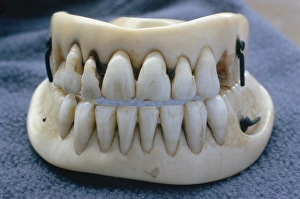 Stampe di I denti falsi di Waterlo. Queste dentiere vittoriane erano fatte con vere denti incastonati in avorio (in cima e in basso) Immagini datate 2003 novembre: Denti artificiali di Waterloo