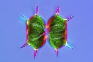 Polarised Light Microscopy Stampe: Xanthidium desmids, light micrograph