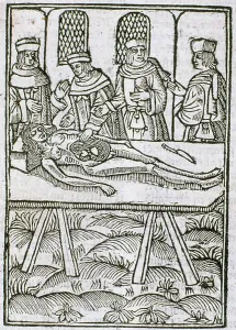 Internal Human Anatomy Stampe: A dissection in progress