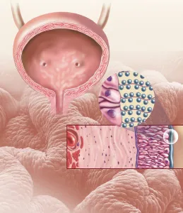 Female Reproductive System Anatomy Stampe: Detail of the cellular structure that forms the bladder lining