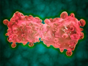 Visuale microscopica di una cellula leucemica.