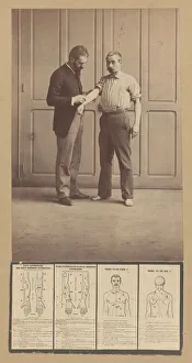 Alphonse Bertillon Stampe: Notation of Scars, Schematic Drawings, ca. 1893. Creator: Alphonse Bertillon