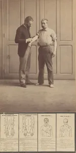 Notazione delle Cicatrici, Disegni Schematici, ca. 1893. ca. 1893. Creatore: Alphonse Bertillon