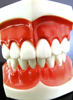 Dental Prosthesis Stampe: False teeth