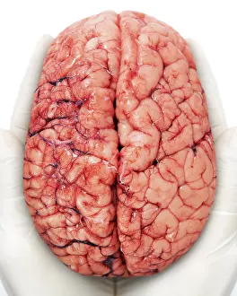 Brain Anatomy Stampe: Human brain