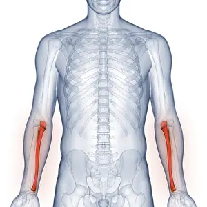 X Ray Examination Stampe: Image converted using ifftoany