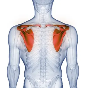 Upper Arm Injury Diagnosis Stampe: Image converted using ifftoany