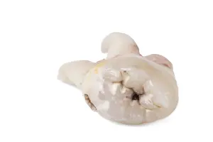 Bright Light Photography Stampe: Pulled wisdom tooth, tooth, carious