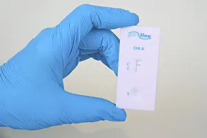 Sexually Transmitted Disease Test Stampe: Quick test Chlamydia from ProLine