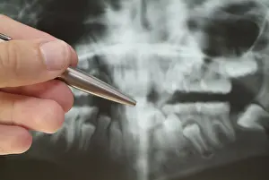 Medical Consultation Stampe: Radiograph