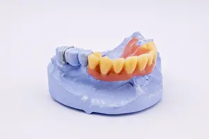 Upper Jaw Denture Stampe: Removable denture of an upper jaw