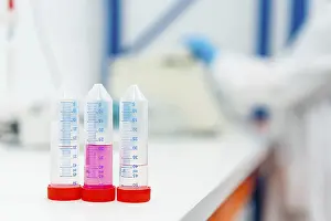 Medical Examination Process Stampe: Three tubes with samples in the table of a laboratory with someone working on the background