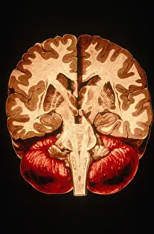 Human Brain Anatomy Stampe: Brain, Coronal Section