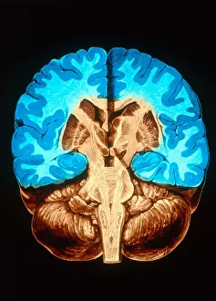 Human Brain Anatomy Stampe: Brain, Coronal Section