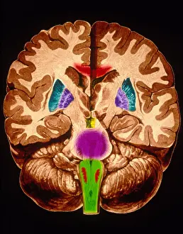 Human Nervous System Stampe: Brain, Coronal Section