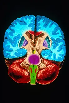 Human Brain Anatomy Stampe: Brain, Coronal Section