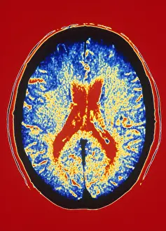 Human Brain Anatomy Stampe: Brain, CT Scan