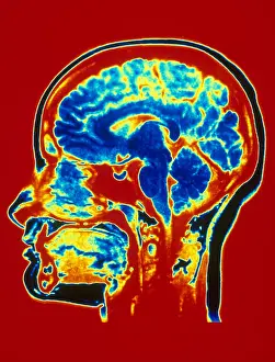 Brain MRI Scan Stampe: Brain MRI