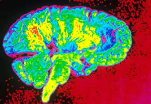 Human Brain Anatomy Stampe: Human Brain