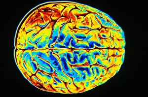 Nervous System Diagrams Stampe: Human Brain