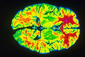 Magnetic Resonance Imaging Stampe: Human Brain
