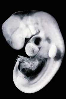 Scanning Electron Microscope Images Stampe: Human embryo