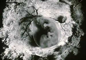 Human Embryo Development Stampe: Human Embryo
