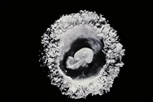 Scanning Electron Microscopy Stampe: Human embryo