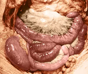 Human Anatomy Stampe: Intestines