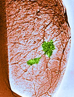 Medical Imaging Techniques Stampe: Mammogram