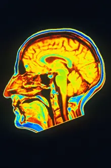 Normal Brain Anatomy Stampe: MRI of Brain