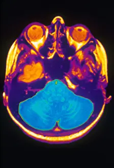 Cerebral Cortex Structure Stampe: MRI of Brain