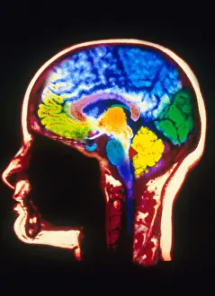 Magnetic Resonance Imaging (MRI) Stampe: MRI of Head