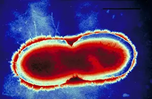 Electron Microscopy Images Stampe: Pseudomonas cepacea