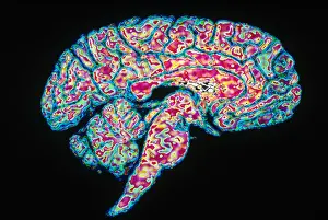 Human Nervous System Stampe: Sagittal Section of Brain