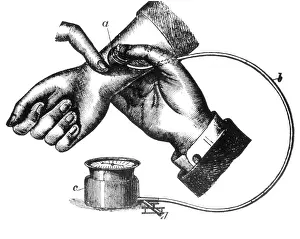 Blood Pressure Measurement Stampe: Sphygmomanometer, 1883